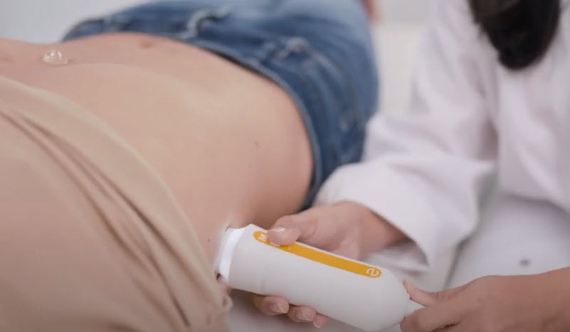 fibroscan